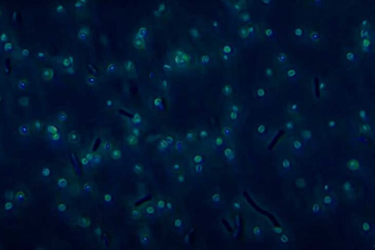 Seipasa presenta en España el nuevo biofungicida Seitylis