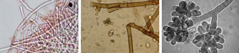 Botrytis cinerea en lechuga estrategias de control eficaces y sostenibles 2